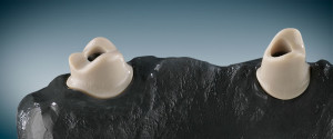 ceramill-peek-header